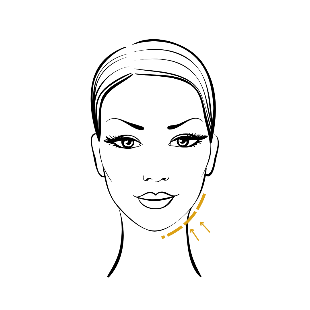 Woman's body illustration highlighting the location of the Silicone facial implants